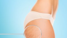 Смутита за детокс и елиминиране на целулита