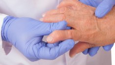 Храни, полезни при артрит