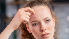 Сърбеж по челото – какви могат да са причините