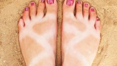 Искате да премахнете слънчевия загар? Ето как