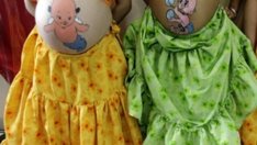 Преяждането и недохранването са еднакво вредни при бременност