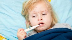 Морбили – какво трябва да знаем за дребната шарка?