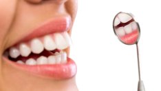 5 изненадващи фактора, развалящи зъбите