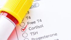 Как да намалите кортизола в тялото 