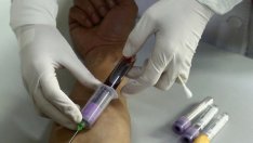 Кръвен тест ще показва дали ракът се връща отново