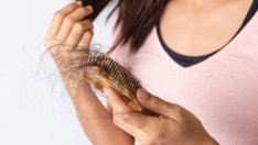 Косопад при жените: 4 причини, които да имате предвид