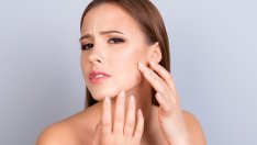 Храни, повишаващи риска от поява на акне 