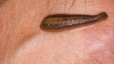 Абсурдни методи на лечение от миналото