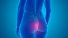 Полезни храни при хемороиди