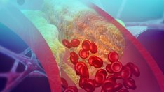 4 витамина за здрави вени