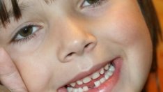 Първият стоматологичен преглед на детето