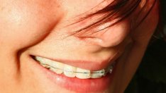 Кога да се сложат първите шини