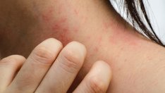 Кожни проблеми – симптоми на диабет