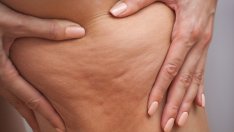 9 мощни храни срещу целулит