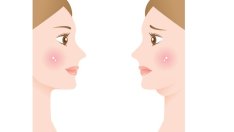 Как да премахнете двойната брадичка