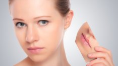 3 билки при херпеси