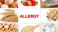 Митове за алергиите