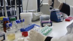 Тест ще показва колко напреднал е меланомът 