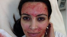 Ким Кардашиян се подмладява с кървав лифтинг