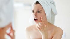 Появата на акне може да подсказва за здравословни проблеми и не само