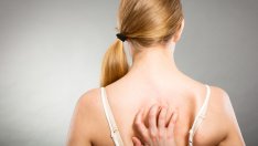 Как да се отървете от акнето по гърба