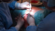 За пръв път у нас телемост свърза 3 болници по време на операция