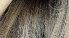 11 причини за косопад