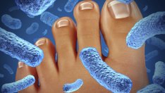 Народни лекове при гъбички по краката 