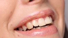 Вредни навици, които предизвикват поява на бръчки