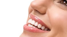 Най-подходящите храни за избелване на зъбите (галерия) 