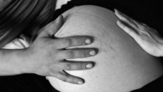 Как да се предпазим от стриите?