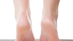 Витамини и минерали при напукани пети