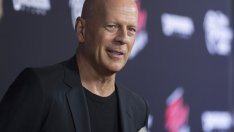 Защо плешивите мъже са секси?