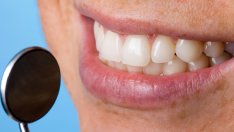 4 заболявания, свързани със зъбните инфекции