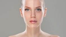 Как лицето може да подскаже за здравословен проблем?