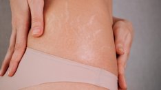 6 продукта, които ще ви спасят от стриите