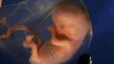 Преди аборт ти дават да чуеш сърцето на бебето