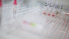 Откриха причината за честите спонтанни аборти