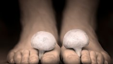 Натурални лекове при гъбички по ноктите 