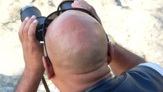 Нов метод е на път да реши проблема с плешивостта