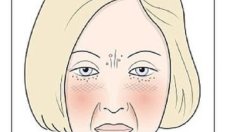 Имате ли „глутеново лице“