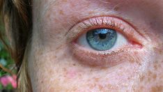 Как да намалите появата на луничките и кафявите петна