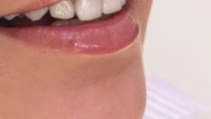 Храни, които се грижат за здравето на венците и зъбите