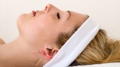 7 здравословни ползи от акупунктурата