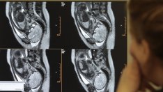След колко менструални цикъла и редовен секс настъпва бременност?