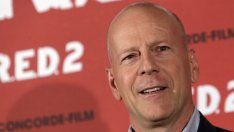 Какво помага при косопад?