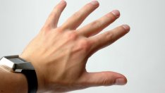 Хранене при витилиго