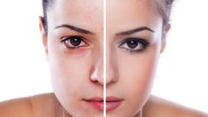 Как чертите на лицето подсказват за различни заболявания?