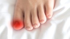 Как да се справите с врасналите нокти на краката?