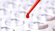 Най-честите причини, поради които хората не даряват кръв